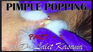 PIMPLE POPPING PART 1 [upl. by Ori]