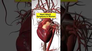 Heart Attack Symptoms in Women [upl. by Cirri22]