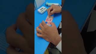 widal test for typhoid fever [upl. by Ahsatsan]