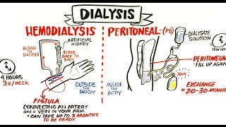 Failing Kidneys and Different Treatment Options [upl. by Moriah]