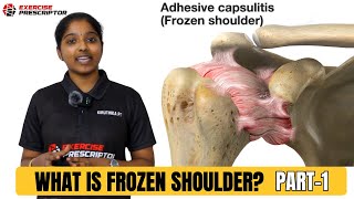 What is frozen shoulder   painful shoulder  shoulder stiffness [upl. by Perkins]