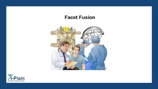 Facet Fusion [upl. by Icul]