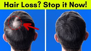 5 Proven Ways to Regrow Your Hair Naturally [upl. by Lenes406]