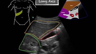 POCUS  Gallbladder Ultrasound Anatomy [upl. by Airdnaz663]