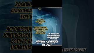 AC joint dislocation shorts mbbs neet trending orthopedics [upl. by Nhguavad]