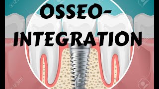 Osseointegration Principle Mechanism amp factors Branemark prosthesis Dental implant lecture [upl. by Zackariah]