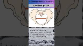 Female Gynecoid pelvis  Normal pelvis  Types of pelvis OBG amp GYNAE ytshort [upl. by Atiuqan924]