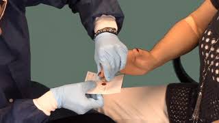 ISDH Phlebotomy How to Perform a Fingerstick Procedure [upl. by Hgielram]