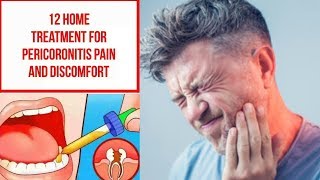 12 Home Treatment For Pericoronitis Pain and Discomfort [upl. by Aleemaj]