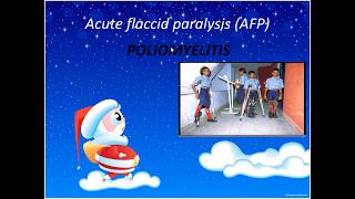 Acute Flaccid Paralysis Pediatrics [upl. by Eelyk]