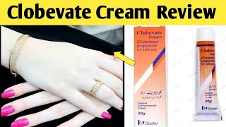 Clobevate Hand Whitening Cream Review Price Benefits Side Effects  Clobevate Cream For Whiten [upl. by Ilwain112]