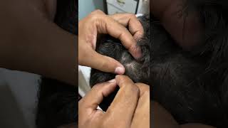 Mom remove lice from school girl hair at home vlog  hair makeover 1 [upl. by Dnyletak]