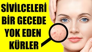 SİVİLCELERİ BİR GECEDE YOK EDEN KÜRLER [upl. by Treve]