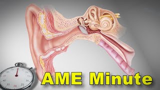 AME Minute Why did the FAA allow AMEs to issue pilots with BPPV [upl. by Warthman]