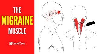 How to Release Tension for FAST MIGRAINE RELIEF [upl. by Rosana]