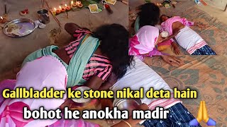 Gollbladder ke stone nikal rahahain Anokha mandir [upl. by Atok]