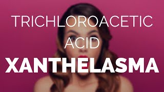 Trichloroacetic acid xanthelasma does it work [upl. by Oran939]