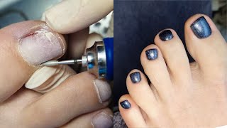 Manicure Transformation 💅 Pedicure Transformation 👣 [upl. by Hulbard]