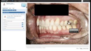 Dental Collaboration Software How to Create a Digital Rx [upl. by Brunk]