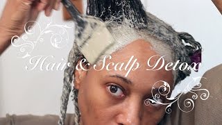 How To Clarify amp Detox Natural Hair amp Scalp [upl. by Ardiedak]