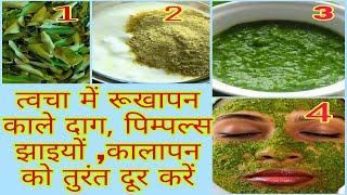 TULSI FACE PACK  REMOVE PIMPLE DARKSPOT ACNE PIGMENTATION SCARS TULSI FOR PIGMENTATION [upl. by Assetak]