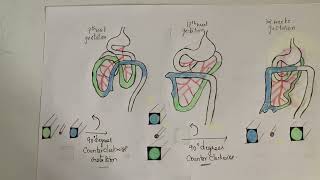 Midgut Rotation made easy [upl. by Braswell]