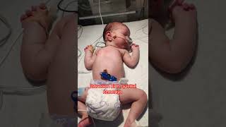 New born baby girl niculife newbornbaby bith retraction by letral nimoniya [upl. by Bethina]