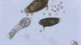 Schistosoma mansoni mother sporocyst and eggs [upl. by Jasik]