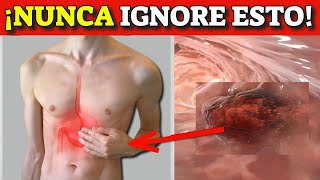 ¡CÁNCER de ESTÓMAGO SÍGNOS y SÍNTOMAS de ALERTA que NUNCA DEBES IGNORAR [upl. by Renba]