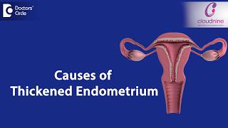 What causes Endometrial thickness  DrSmitha Sha of Cloudnine Hospitals  Doctors Circle [upl. by Cordle840]