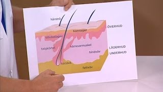 Doktorn svarar Så blir du av med acne och finnar  Nyhetsmorgon TV4 [upl. by Bruyn]