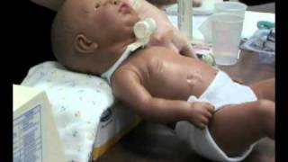 Gastrostomy Tube Training Part 8  Flushing [upl. by Airreis]