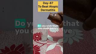 Day87 To Beat Atopic Dermatitis✅️ [upl. by Donatelli499]