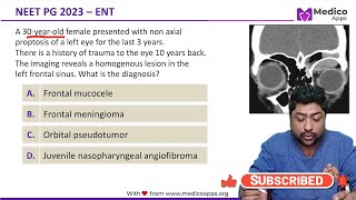 NEET PG 2023 Recall Question  ENT  Frontal Mucocele [upl. by Saoj]