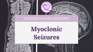 What are Myoclonic Seizures [upl. by Nizam]