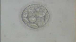 Early Blastocyst [upl. by Ramalahs]