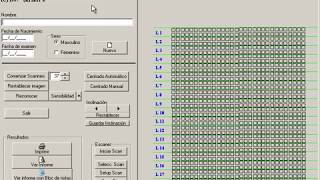 Software Test MMPI1 [upl. by Josh]