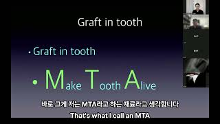 MTA Webinar  Saving natural teeth using MTA [upl. by Razal469]