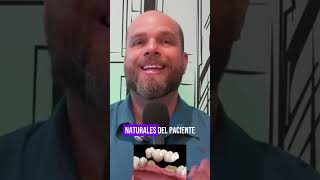 Tipos de prótesis dentales shortsvideo [upl. by Fagen]