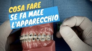 Fa male lapparecchio Ecco cosa fare [upl. by Bibah]