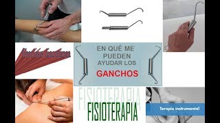 ¿para qué son los ganchos de fisioterapia [upl. by Biel]