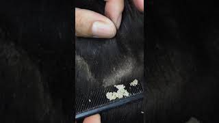 Satisfying Combing and Scratching Dry Scalp shorts dandruff [upl. by Ribaj872]