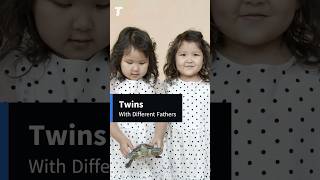 Twins with different fathers  Heteropaternal superfecundation twins facts didyouknow science [upl. by Airrej]