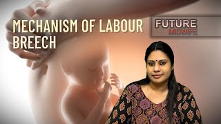 MECHANISM OF LABOURBREECH PRESENTATIONDHANYA DEEPUOBGHIGH RISK LABOUR [upl. by Ogu]