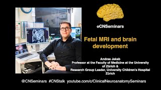 CNStalk  Andras Jakab Fetal MRI and brain development [upl. by Essilem63]