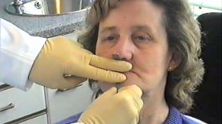 Denture Procedure [upl. by Arlan]