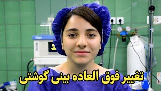 جراحی زیبایی بینی گوشتی دکتر عباس زاده [upl. by Benioff]