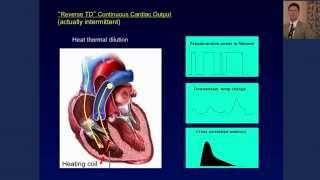 Dr Heerdt Discusses Noninvasive Hemodynamic Monitoring [upl. by Ymerej4]