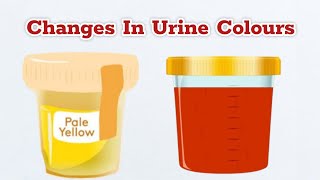 Colour Of Your Urine Says About Your Health bloodinurine [upl. by Avelin]