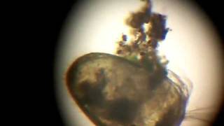 Crazy Ostracod Feeding [upl. by Ahsaf357]